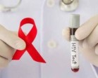 Usia Produktif Dominasi Kasus AIDS di Riau, Laki-laki Paling Banyak Terdampak
