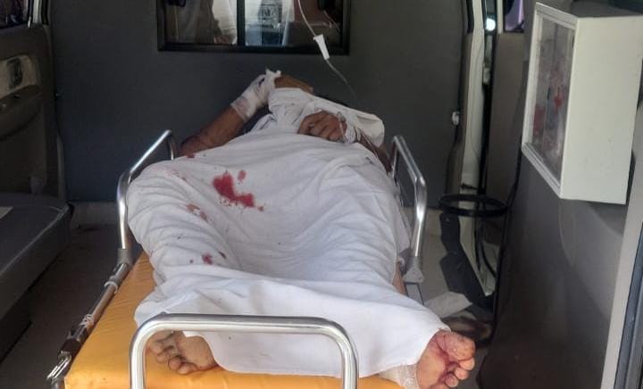 Diserang Beruang Saat Mencari Madu, Warga Kerumutan Ini Luka Parah di Kepala