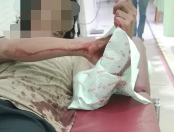 Penganiayaan Warga Mayang Sari, PT Sari Lembah Subur Bungkam.