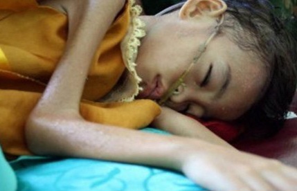 UNICEF: Perubahan Iklim Memperburuk Malnutrisi di Asia