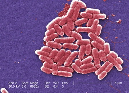 Waspada! Kasus Infeksi Bakteri Resistan Obat Naik 70 Persen di AS