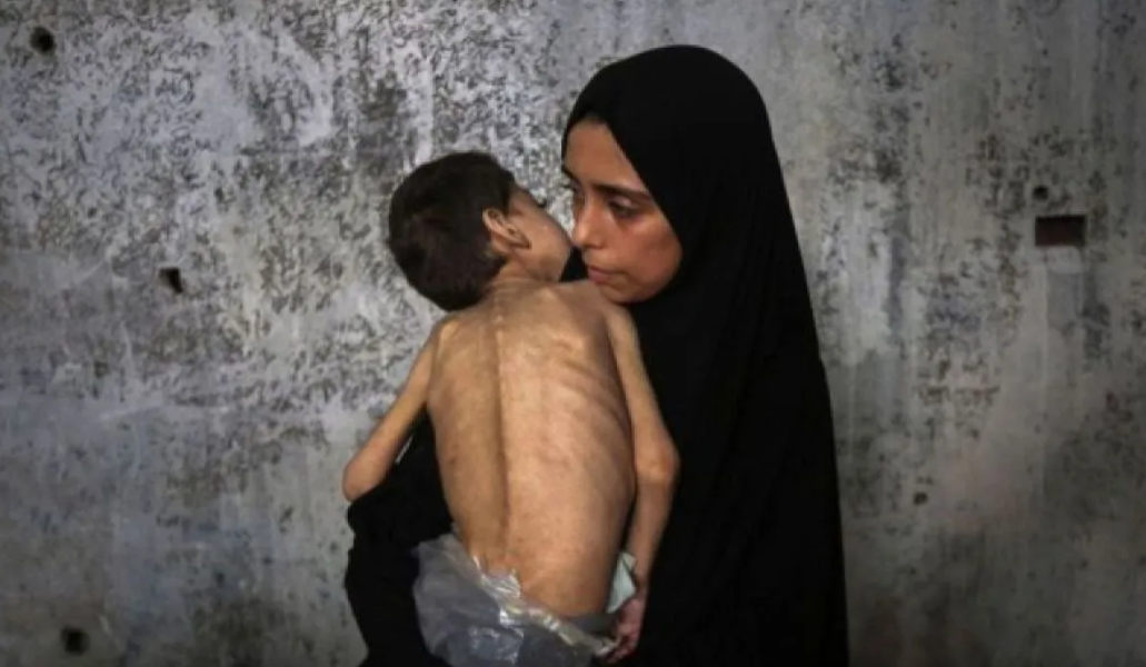 IPC: Gaza Alami Bencana Kelaparan, Pertama Kali Terjadi di Timur Tengah