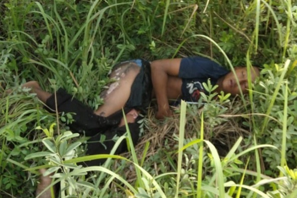 Diduga Alami Keterbelakangan Mental, Anak 14 Tahun Ini Tersengat Listrik di Tiang Powerline PHR